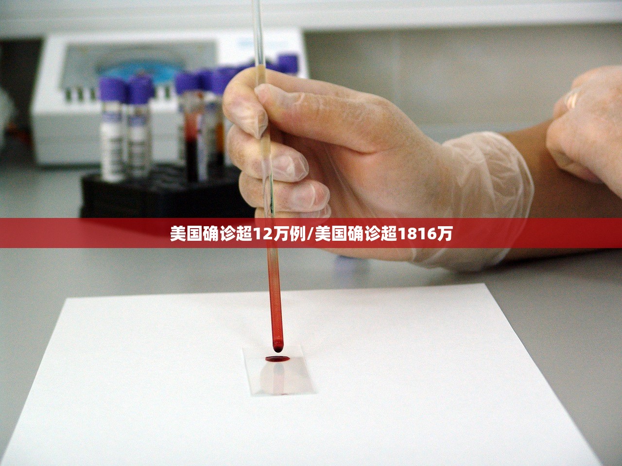 美国确诊超12万例/美国确诊超1816万