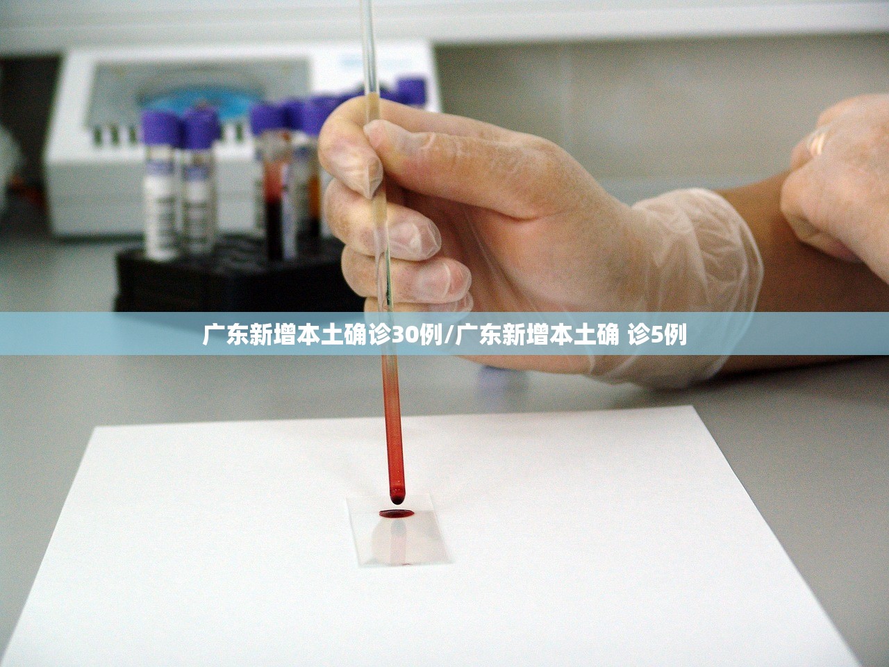 广东新增本土确诊30例/广东新增本土确 诊5例