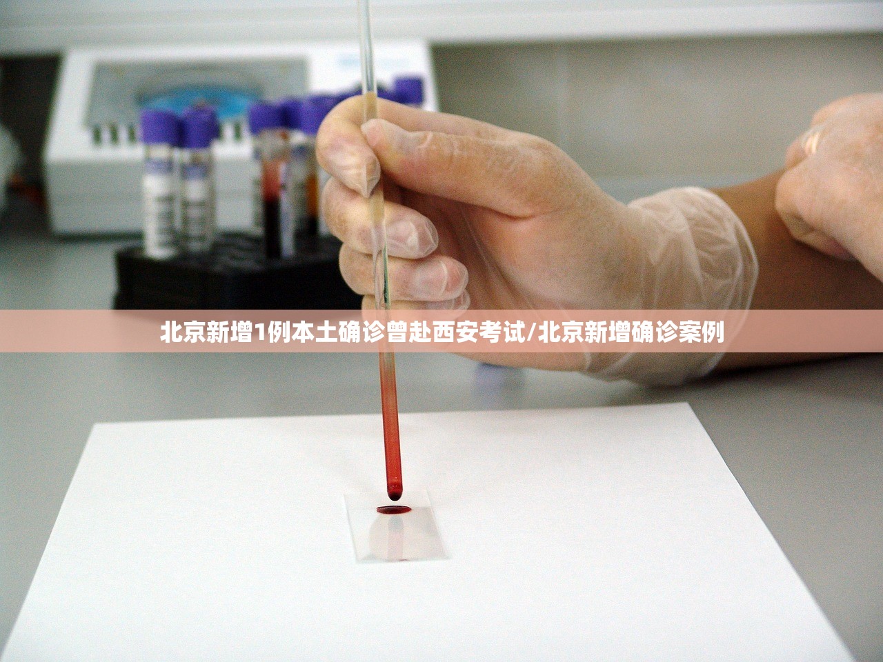 北京新增1例本土确诊曾赴西安考试/北京新增确诊案例