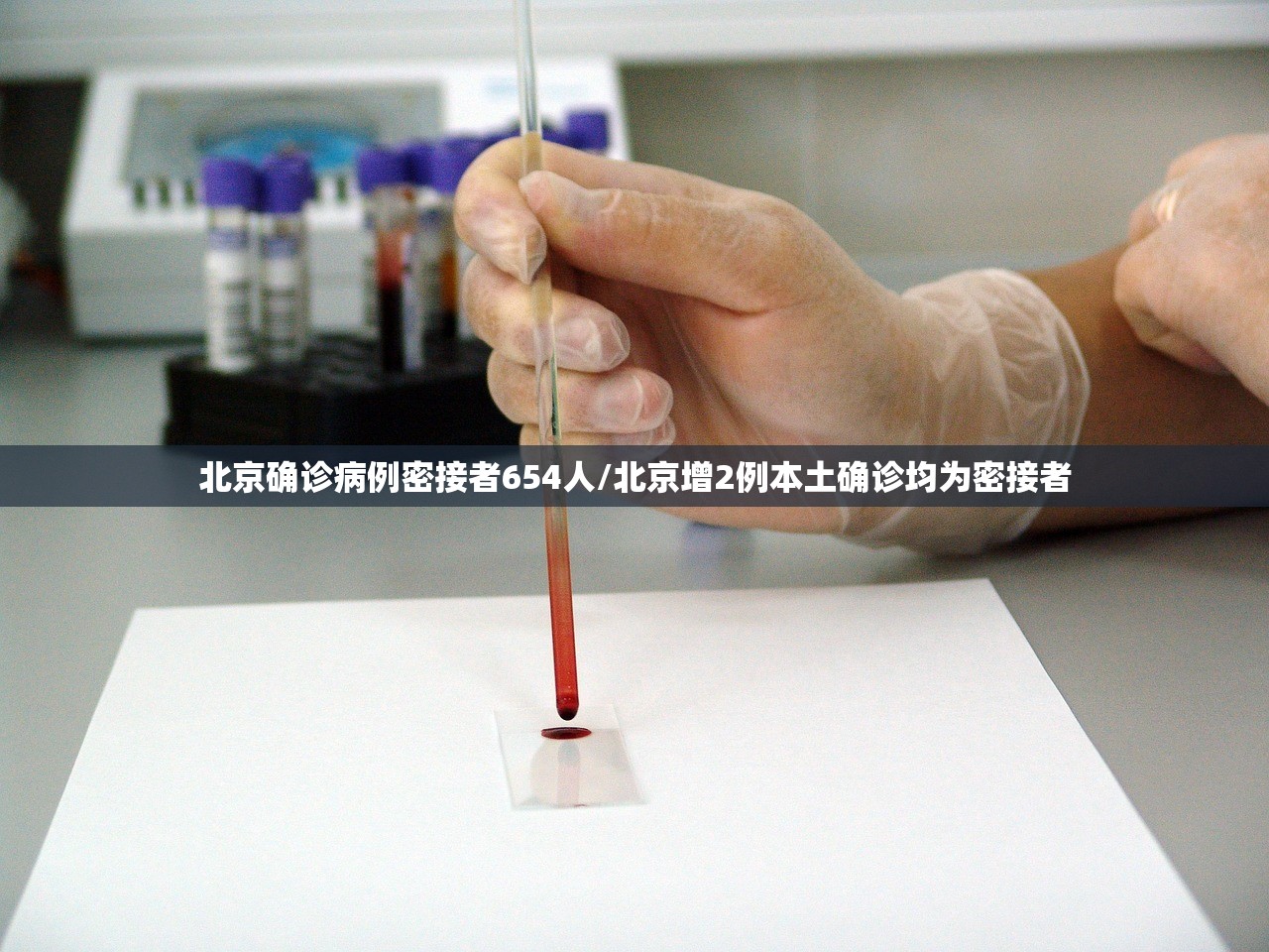 北京确诊病例密接者654人/北京增2例本土确诊均为密接者