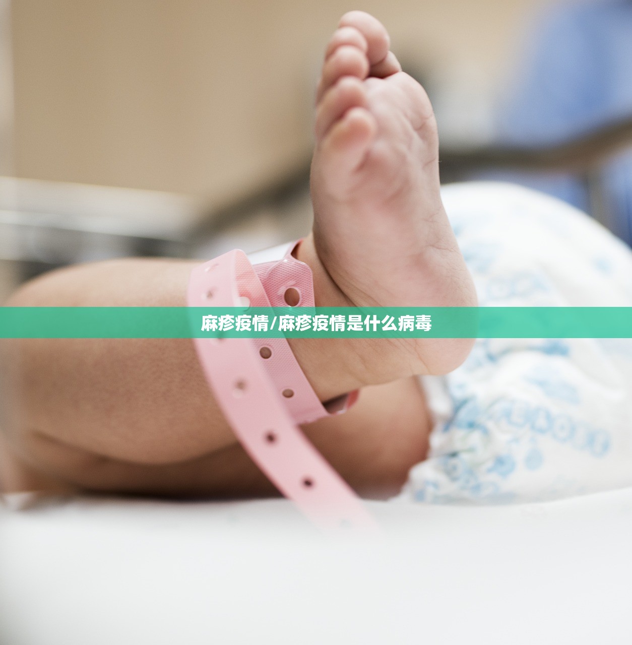 麻疹疫情/麻疹疫情是什么病毒