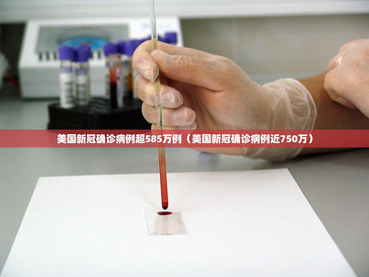 美国新冠确诊病例超585万例（美国新冠确诊病例近750万）