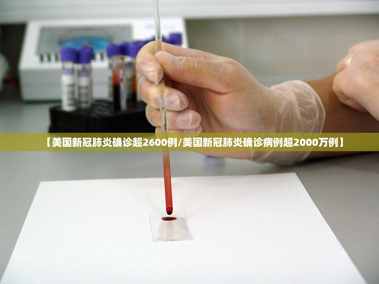 【美国新冠肺炎确诊超2600例/美国新冠肺炎确诊病例超2000万例】
